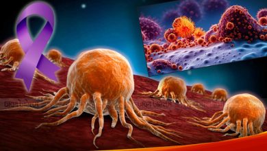 Photo of বাড়ছে মরণরোগ ক্যানসারের ঝুঁকি, জেনে নিন সুস্থ থাকার উপায়